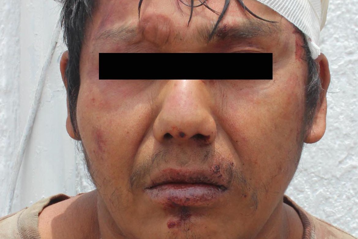Robó a Herbalife y lo tundieron a golpes en la 16 de Septiembre