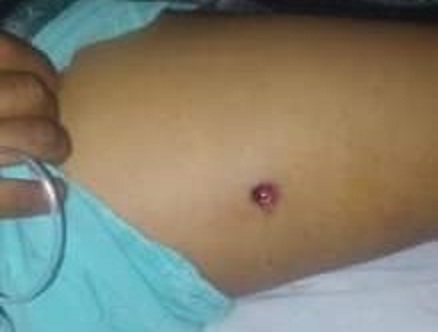 Bala perdida le perforó pierna y glúteo en San Salvador el Seco