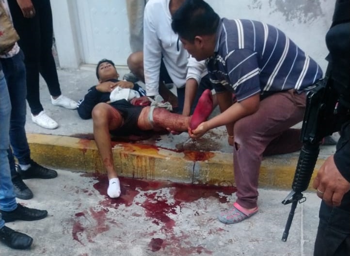 Fue a la tienda y le dispararon en la pierna en la Ignacio Zaragoza