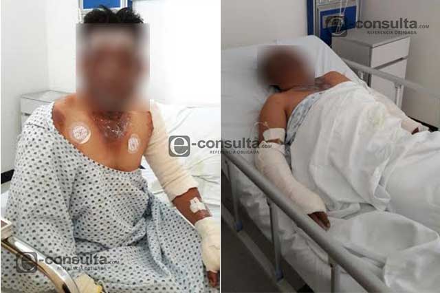 Negligencia de Sonigas habría dejado 3 heridos en Serdán