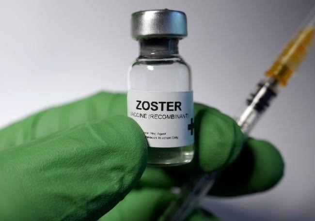 Vacuna contra varicela puede prevenir el herpes zóster: IMSS