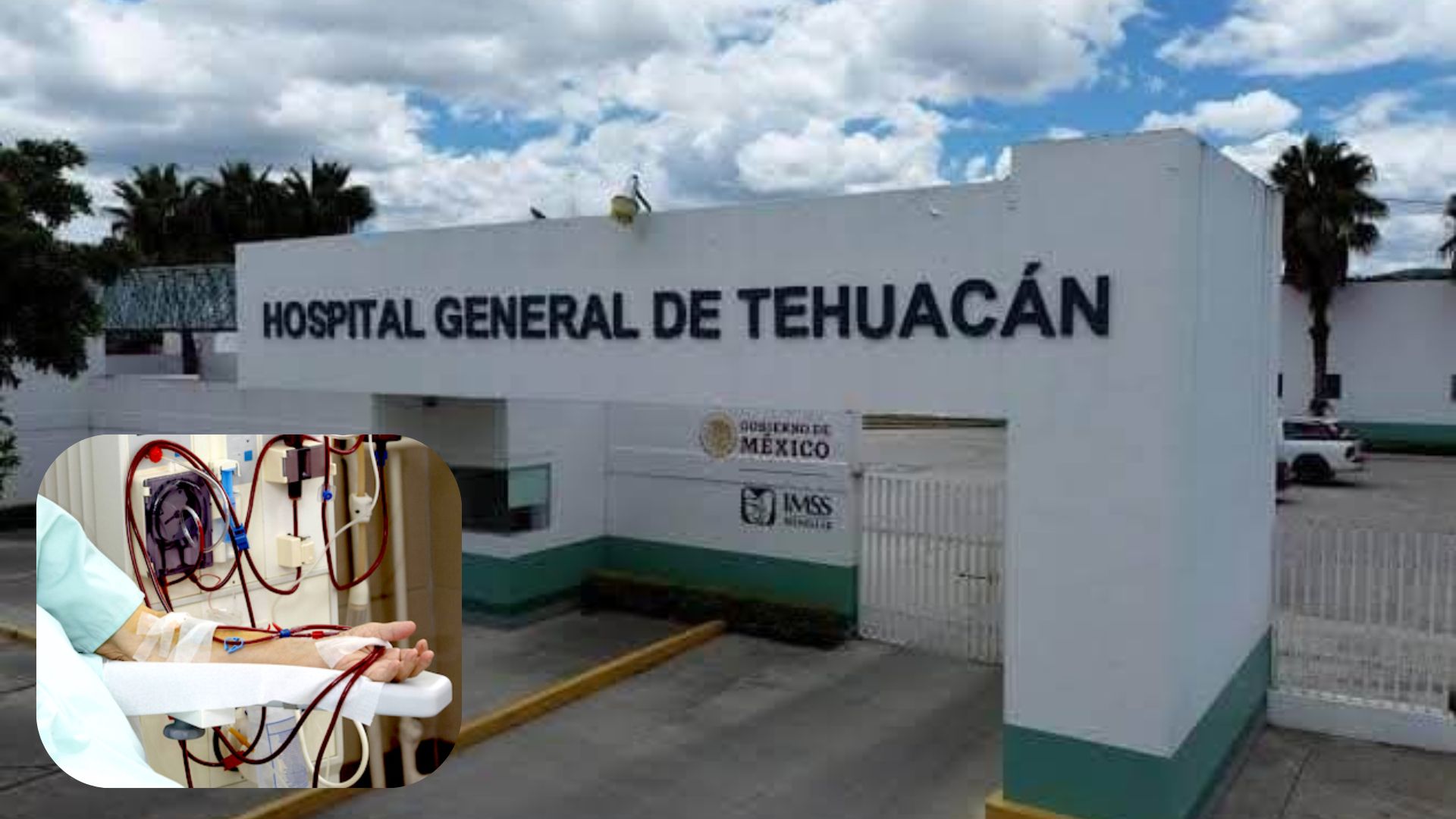 Suspensión de hemodiálisis a pacientes, es por falta de proveedores: IMSS Tehuacán  