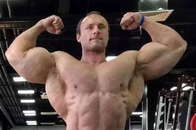 Muere Nikita Tkachuk, el “Hulk ruso”, tras uso prolongado de Synthol