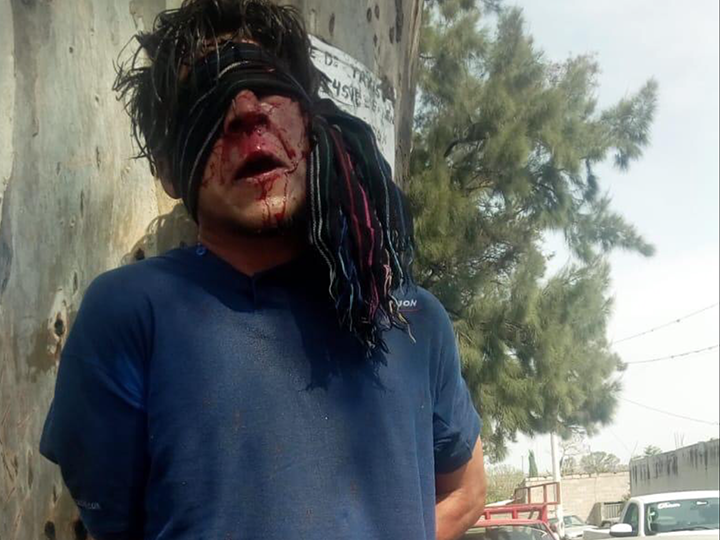 Presunto ladrón pide clemencia por temor a ser linchado en Atlixco