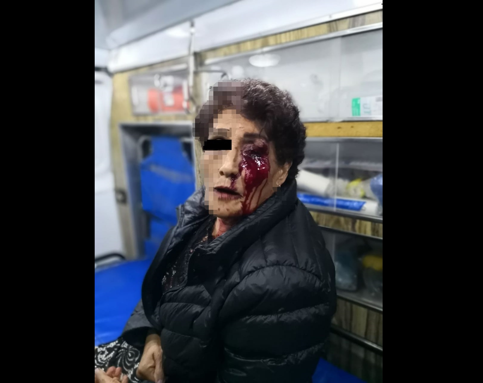 Por verlos dormidos, policías revientan ojo a señora en Atlixco