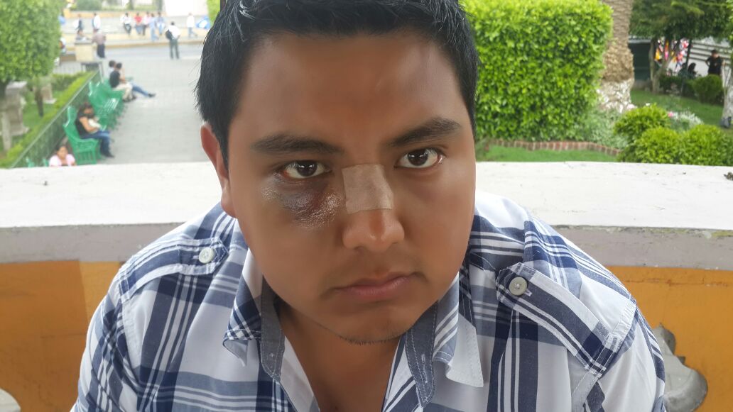 Acepta Policía Auxiliar haber golpeado a reportero en Zacapoaxtla