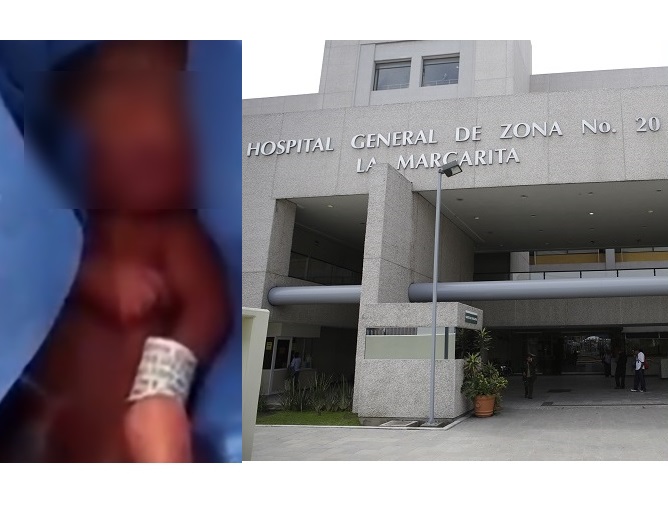 Bebé rescatado de la morgue del IMSS sigue luchando por su vida