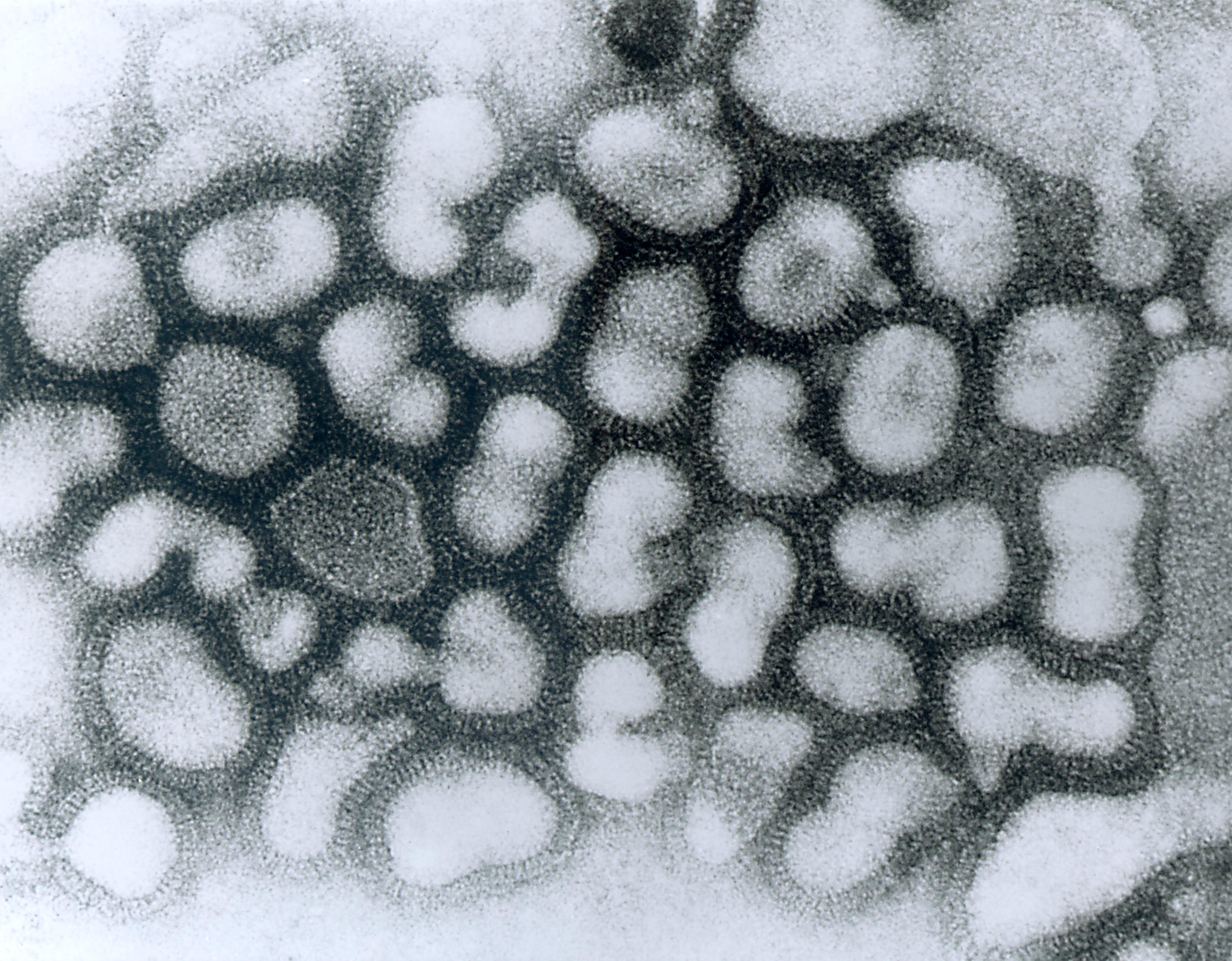 Influenza aviar AH5N1 se puede transmitir a humanos