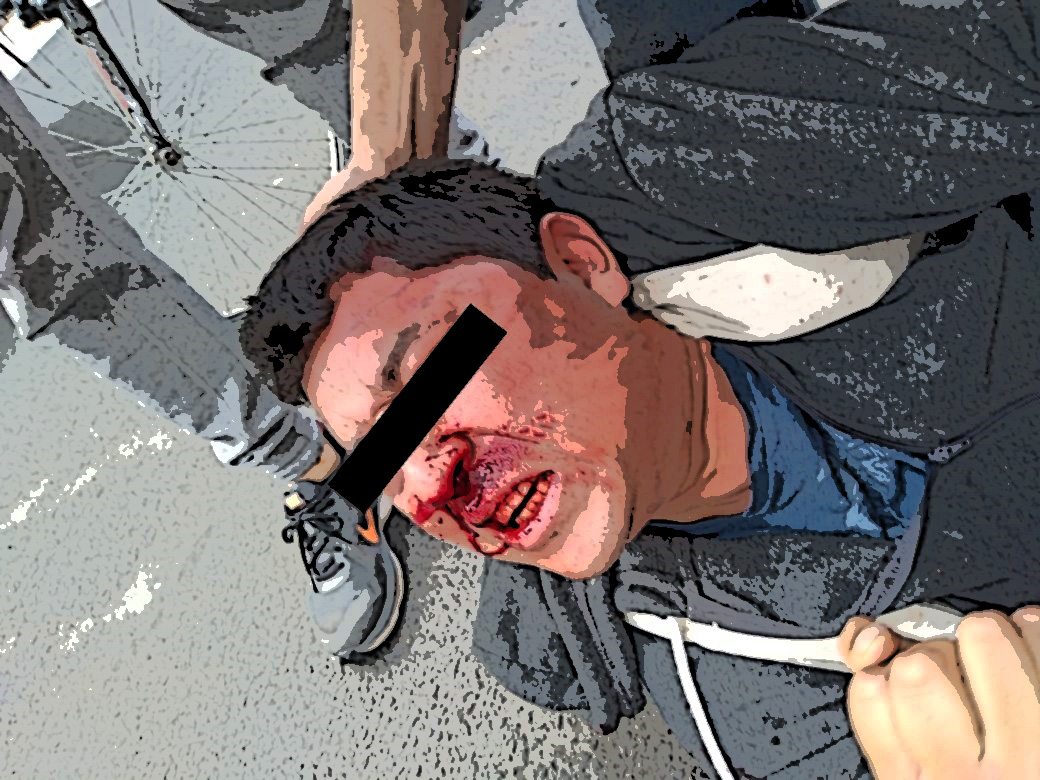 Ciudadanos aprehenden y golpean a dos ladrones en Puebla capital