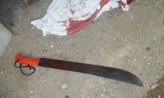 Drogado machetea a su suegra en Atlixco