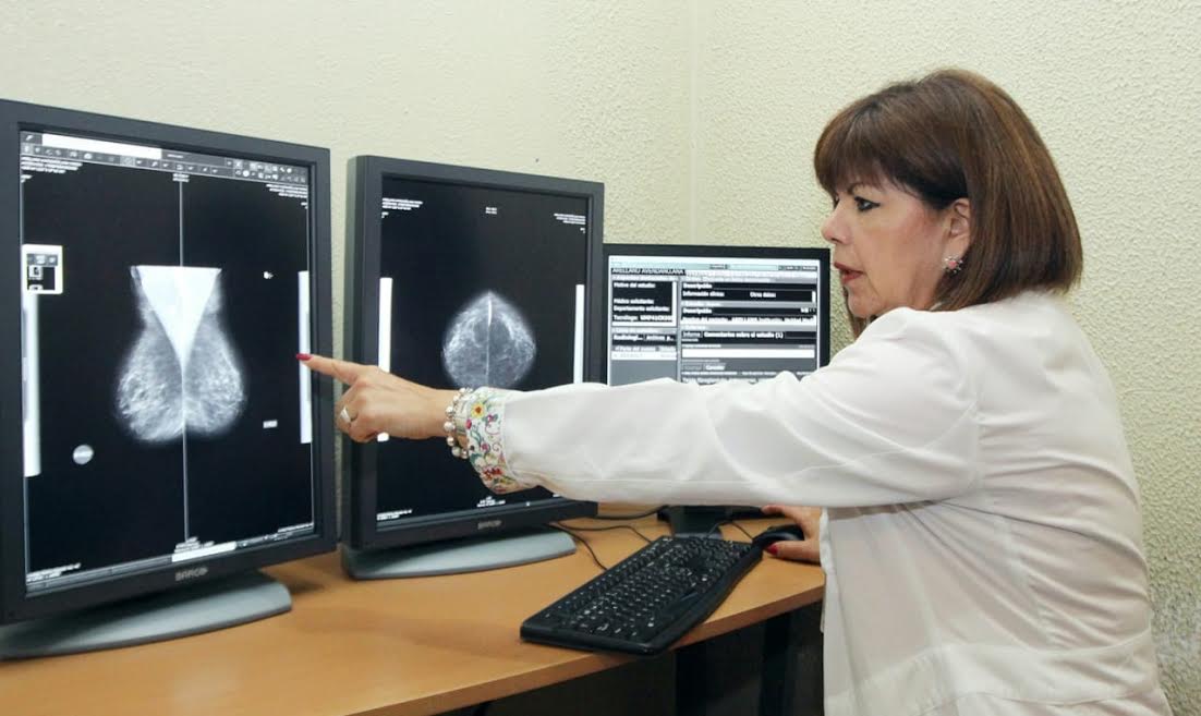 Chequeo una vez al año ayuda a detectar cáncer de mama