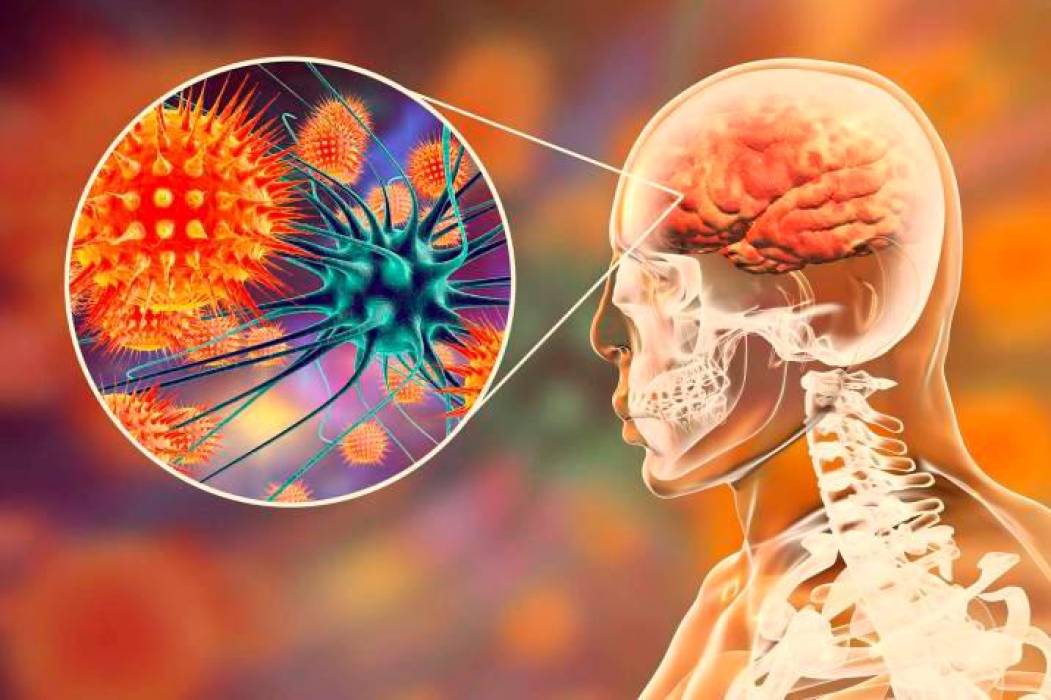 Suman 10 los muertos por meningitis aséptica en Durango