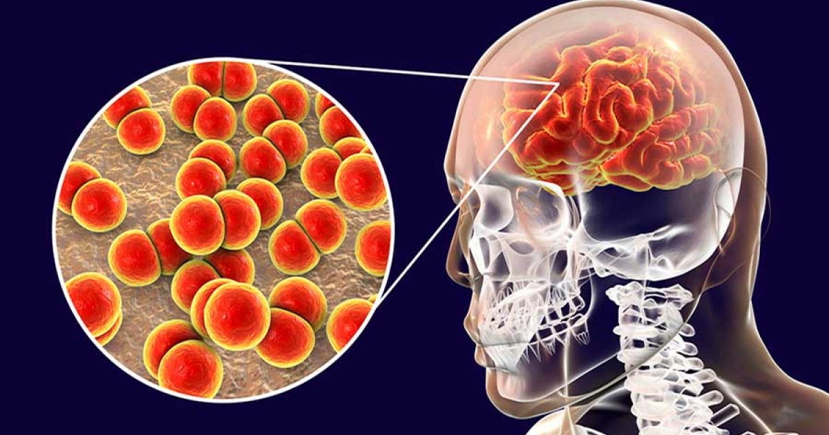 Detienen a trabajador de Coprised por casos de meningitis en Durango