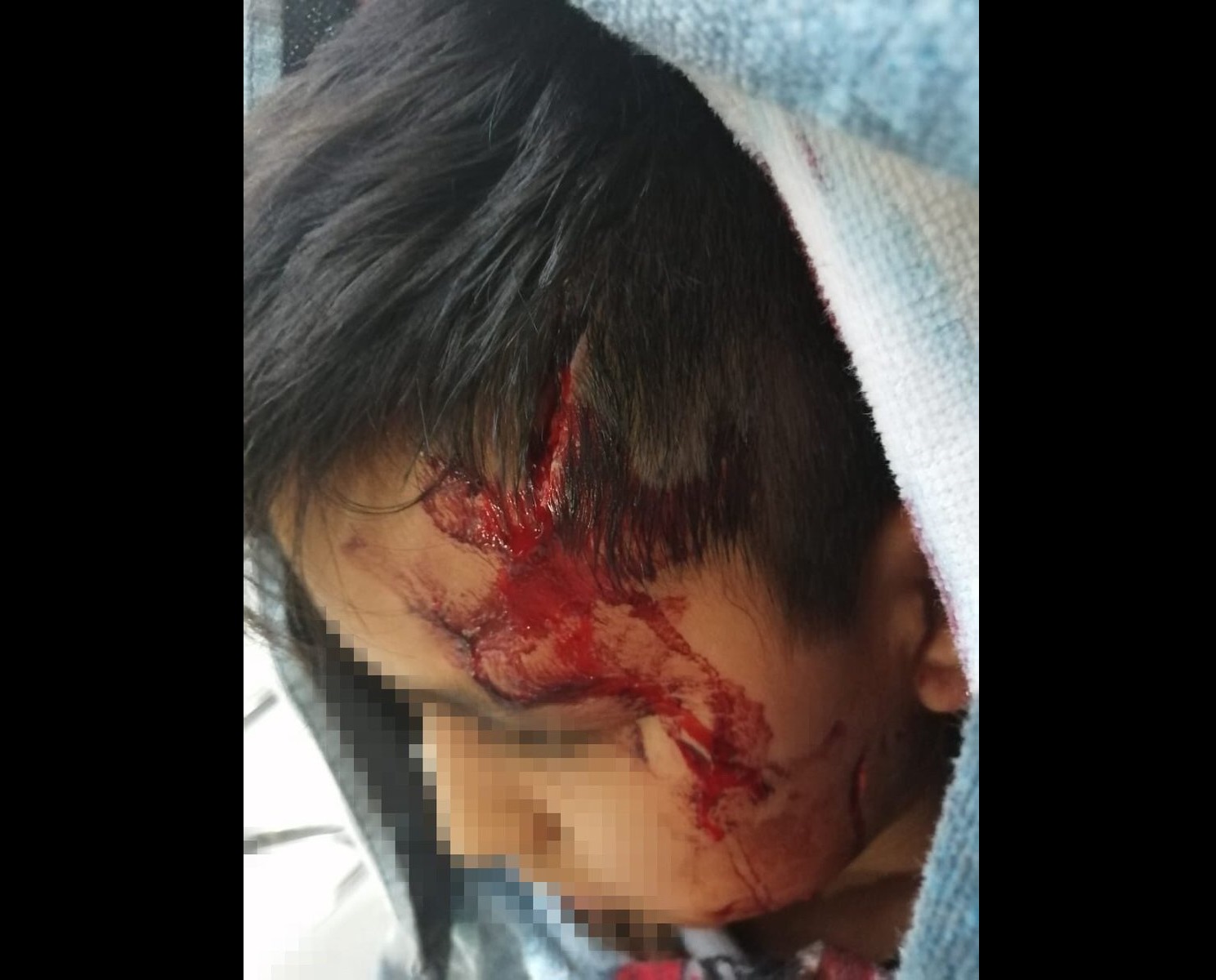 Perro callejero ataca a niño en Loma Bella, van más de 8 casos