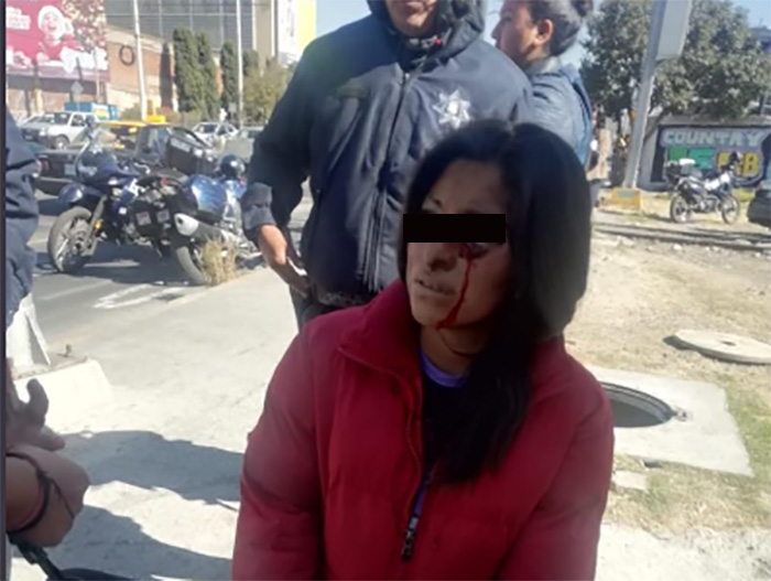 Casi le sacan un ojo a jovencita al robarle su bicicleta