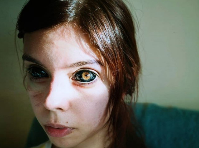 Influencer y modelo queda ciega por tatuarse los ojos