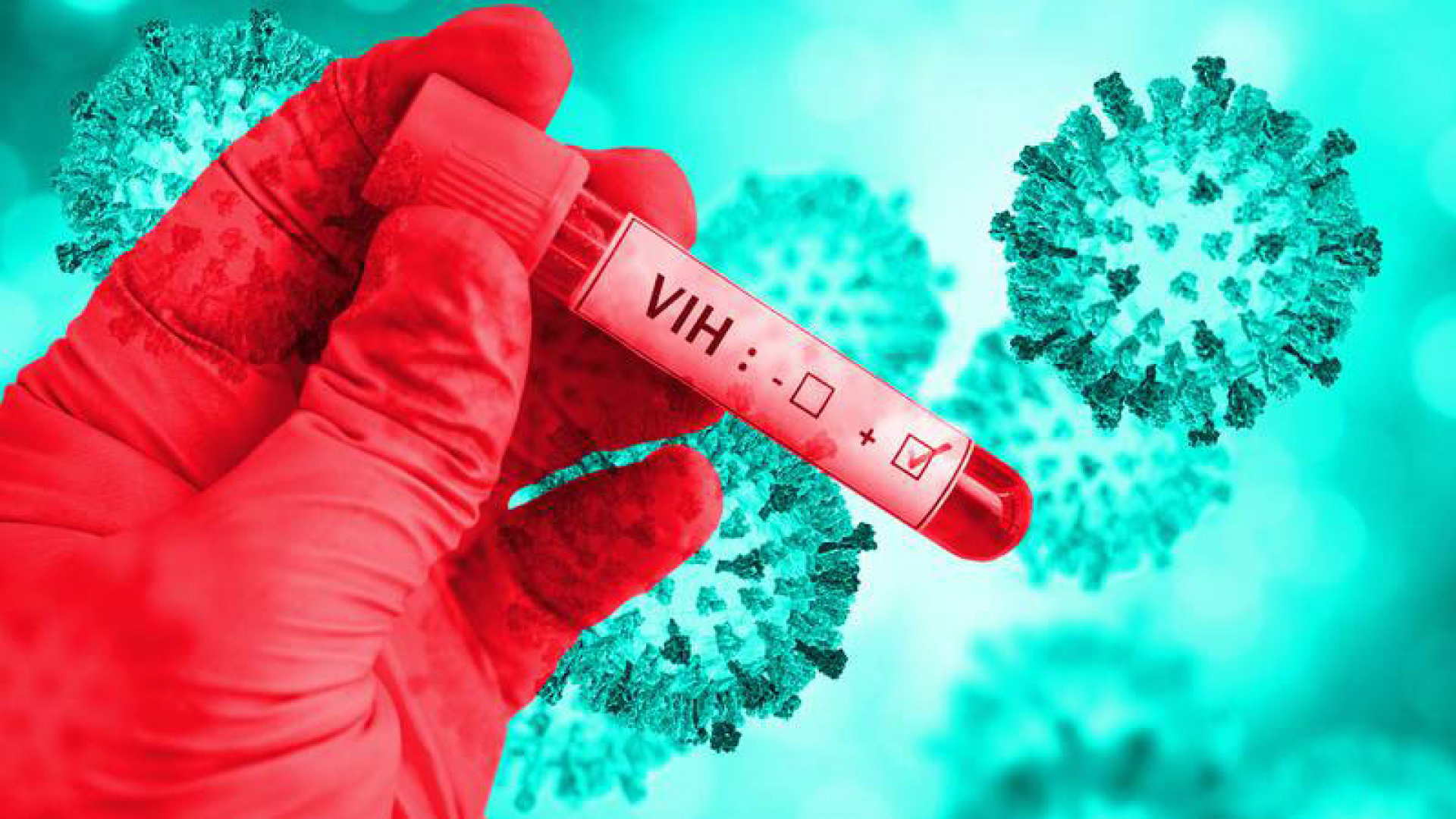 En México, 94% de quienes viven con VIH y reciben tratamiento no transmiten el virus