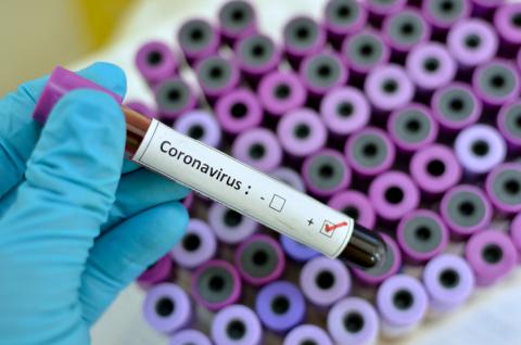 Se confirman tres casos de coronavirus 