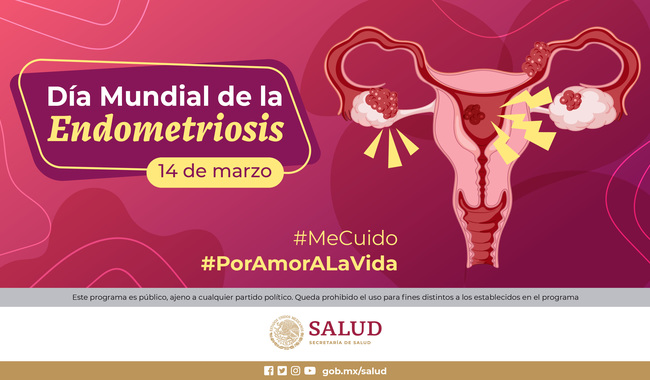 Advierte INPer que endometriosis puede ocasionar infertilidad