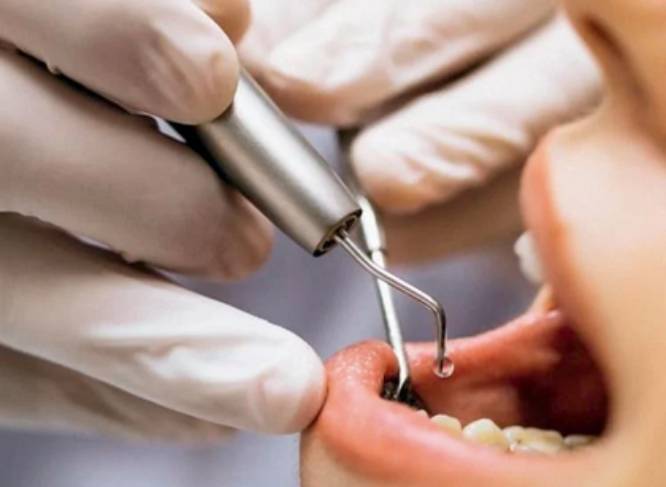 En México, el 57.4% de adultos padece enfermedad periodontal