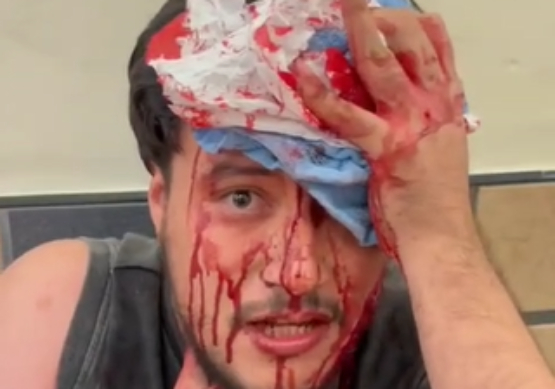 Diputada pide justicia para izucarense atacado en Puebla por presunta homofobia