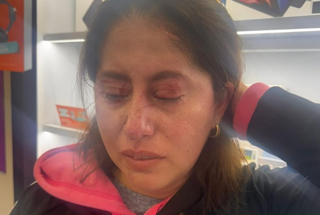 Denuncian violenta agresión contra una mujer en el mercado Juárez de Atlixco