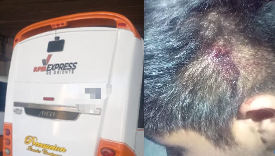 Puebla: atentan contra conductor de RUTA 100