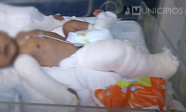 Investigan a papás de bebé fracturado en Huauchinango