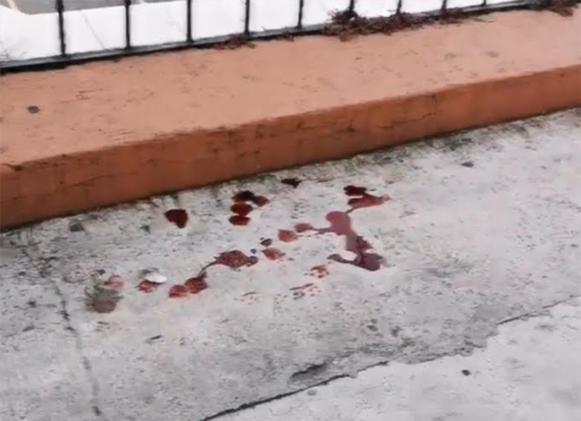 Jauría ataca a abuelita y se desangra en calles de Teziutlán