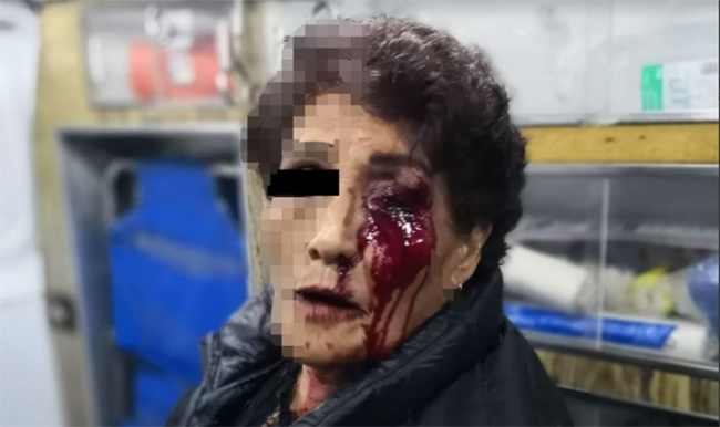 Suspenden a policías golpeadores de Atlixco