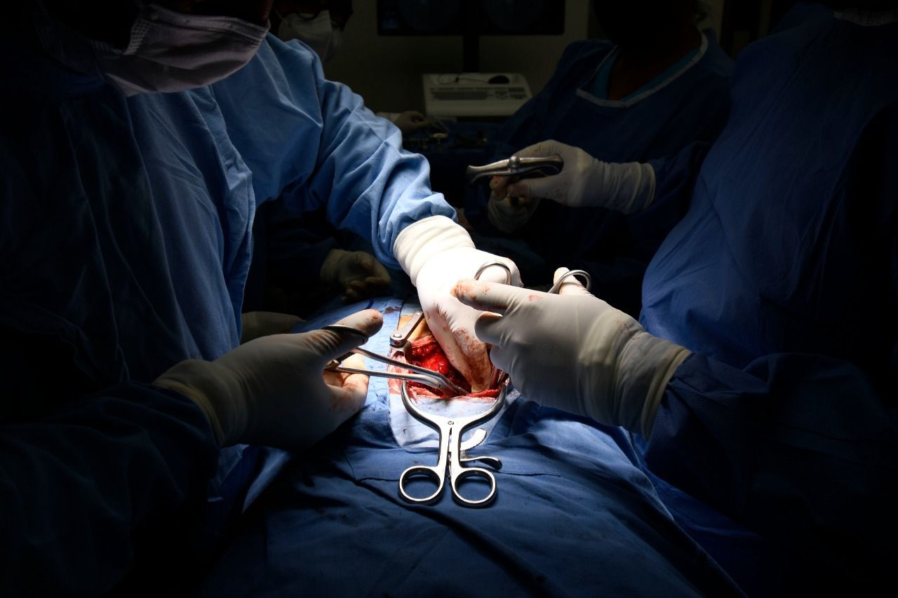 En 2021 IMSS realizó mil 791 trasplantes de órganos y aumentó productividad 212%