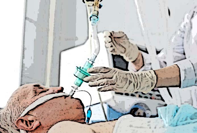 Solo sobrevive el 36% de pacientes intubados por Covid en Puebla