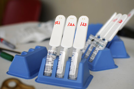 Cuánto cuesta la prueba de coronavirus en laboratorio particular