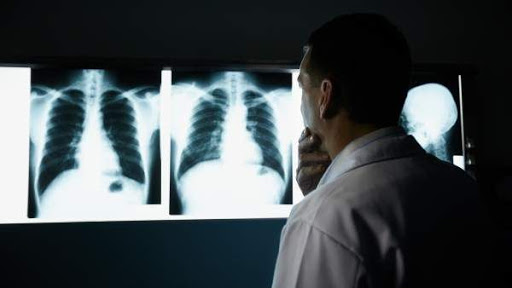 UNAM dará talleres pulmonares para pacientes convalecientes de Covid