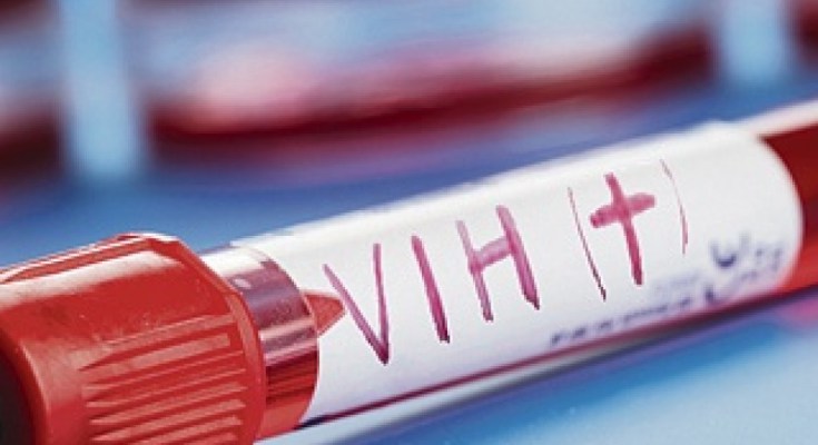 Investiga CDH falta de atención a pacientes con VIH