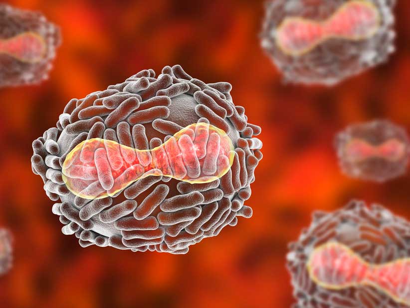 México registra 5 casos de viruela del mono