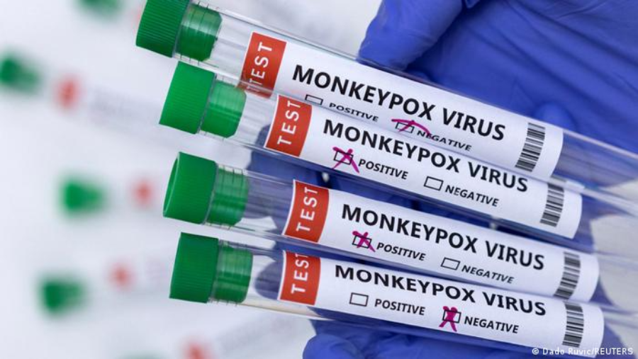Reino Unido recomienda vacuna para viruela del mono en hombres homosexuales y bisexuales