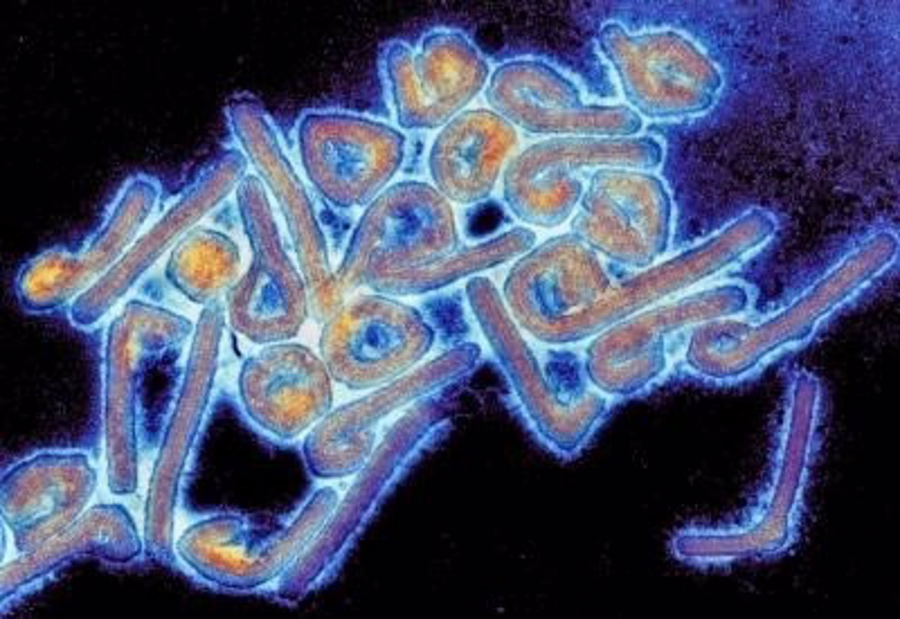 Primeros casos del virus de Marburgo en Ghana confirmados