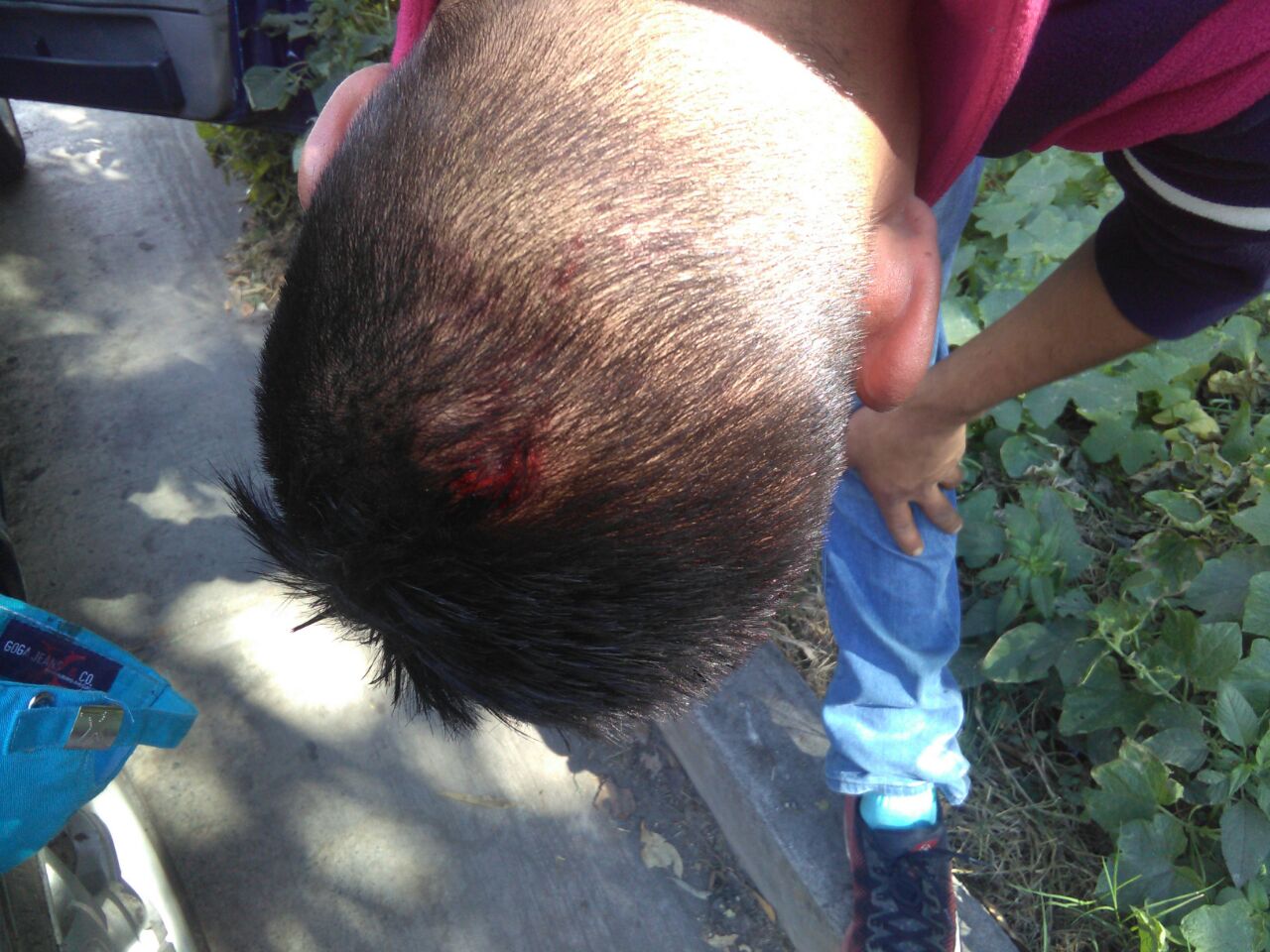 Trifulca deja 7 heridos entre ambulantes y policías de Texmelucan 
