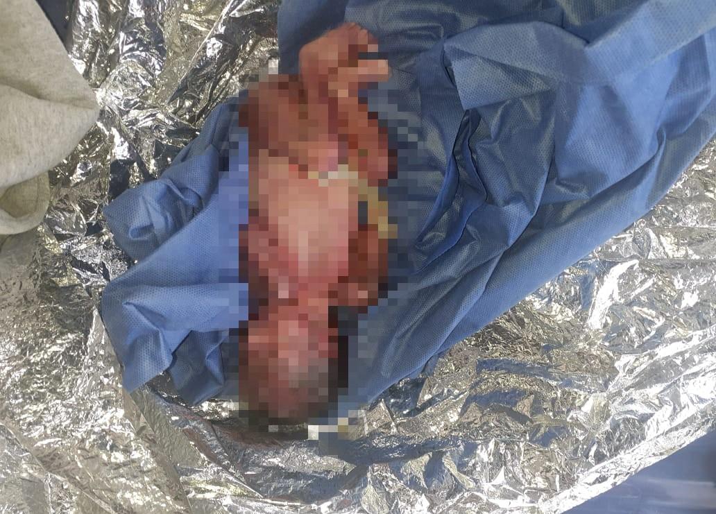 Muere recién nacida abandonada en calles de Tlahuapan
