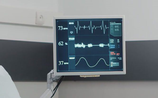 Cofepris avala primer software de alta tecnología para tratamiento de infarto