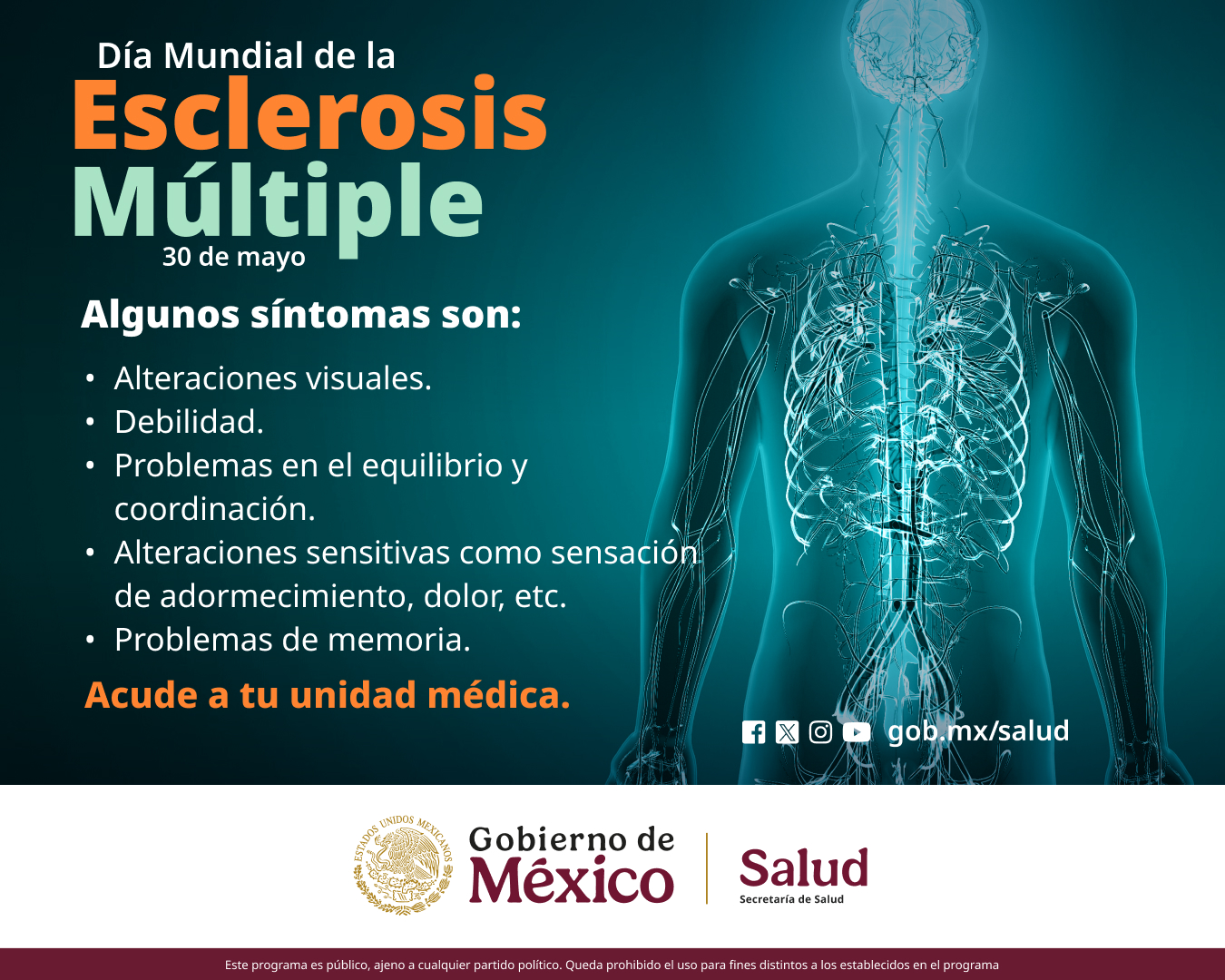 Conoce los signos de alerta de la esclerosis múltiple